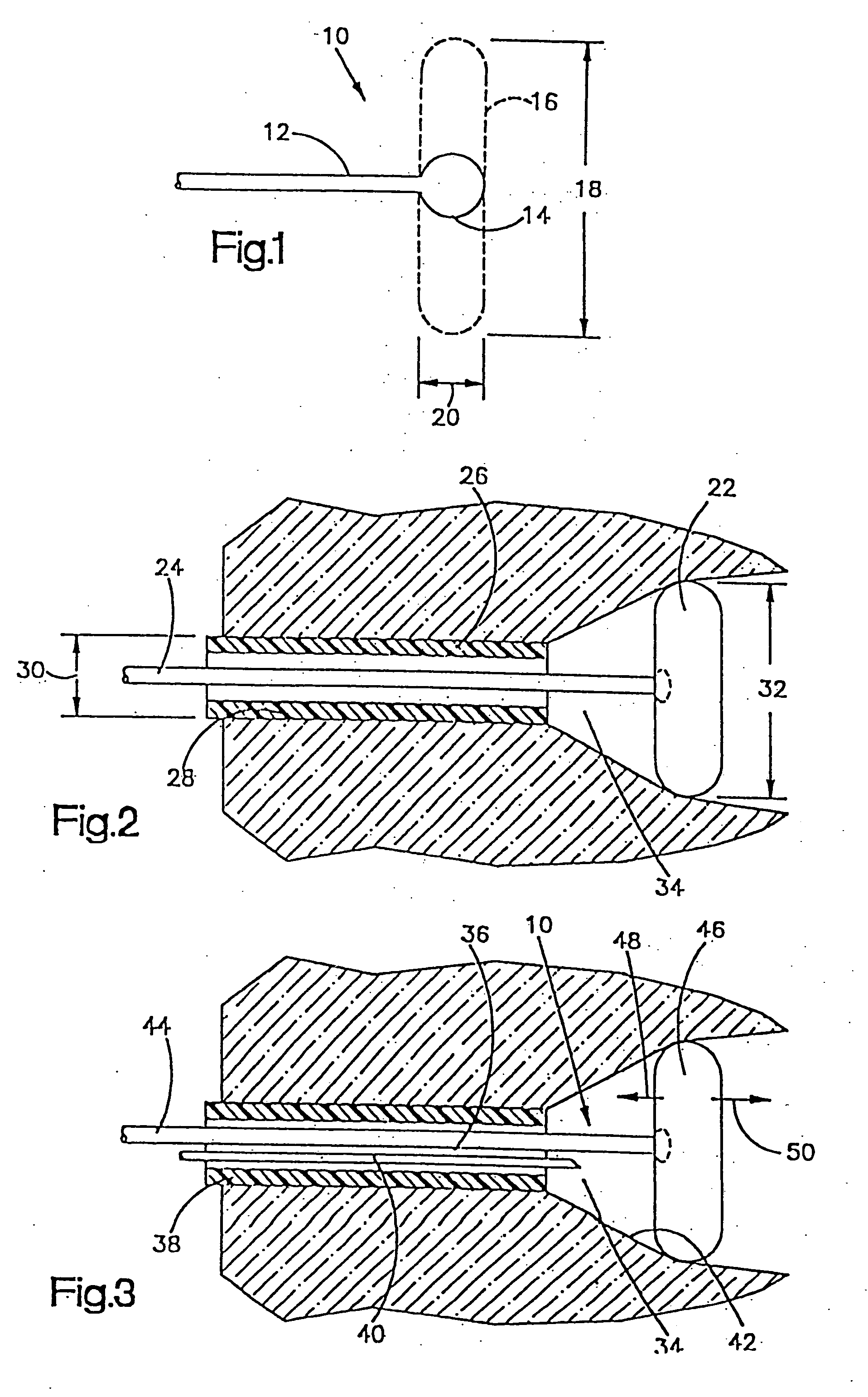 Fluid operated retractors