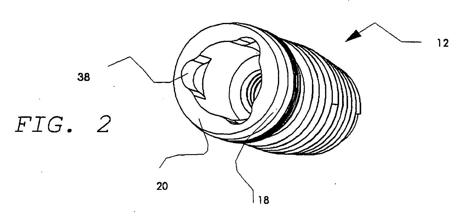 Dental implant system