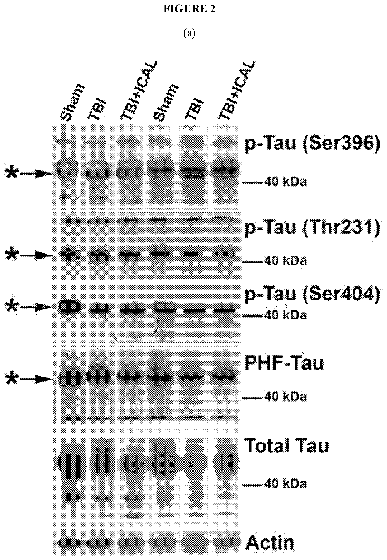 Compositions for increasing resilience to traumatic brain injury