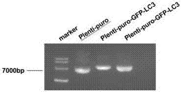 Slow virus green fluorescence autophagy report vector and building method thereof