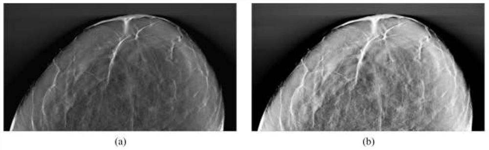 DBT lump automatic segmentation method based on expansion depth convolutional neural network