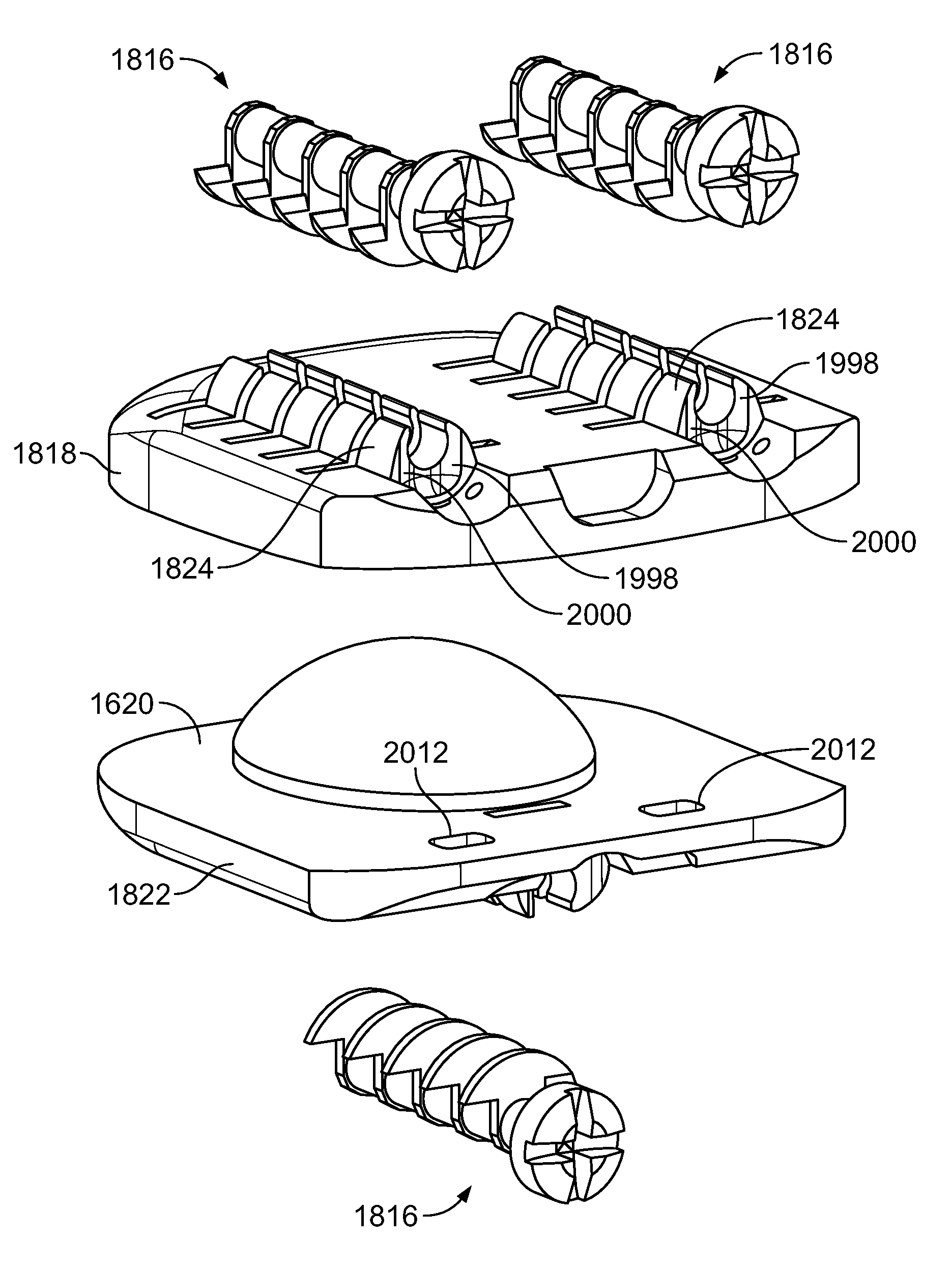 Systems and methods for sizing, inserting and securing an implant in intervertebral space