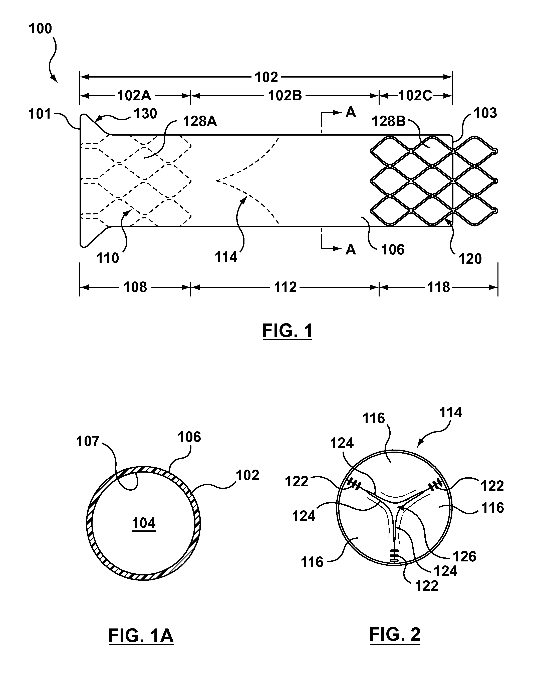 Segmented transcatheter valve prosthesis having an unsupported valve segment