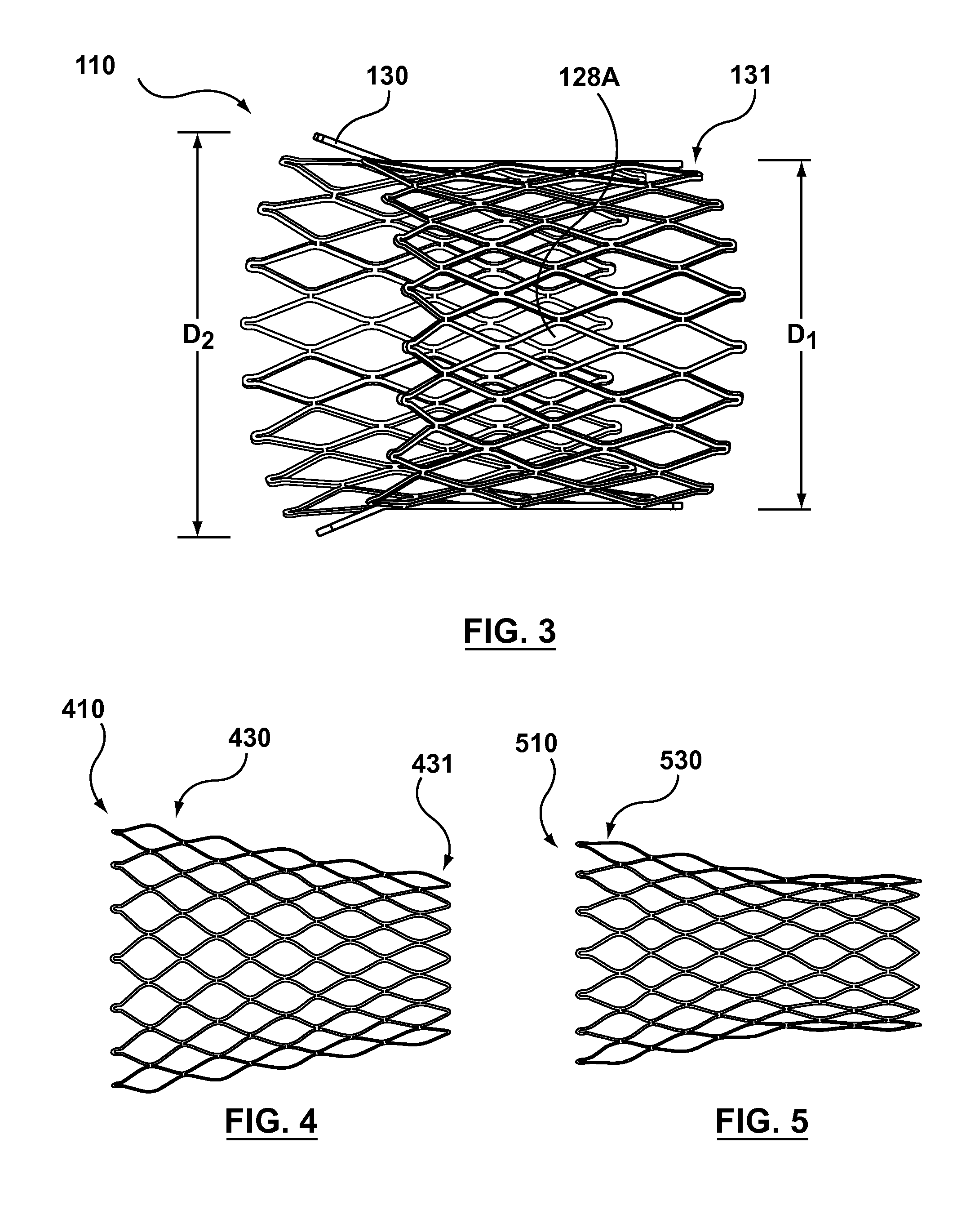 Segmented transcatheter valve prosthesis having an unsupported valve segment