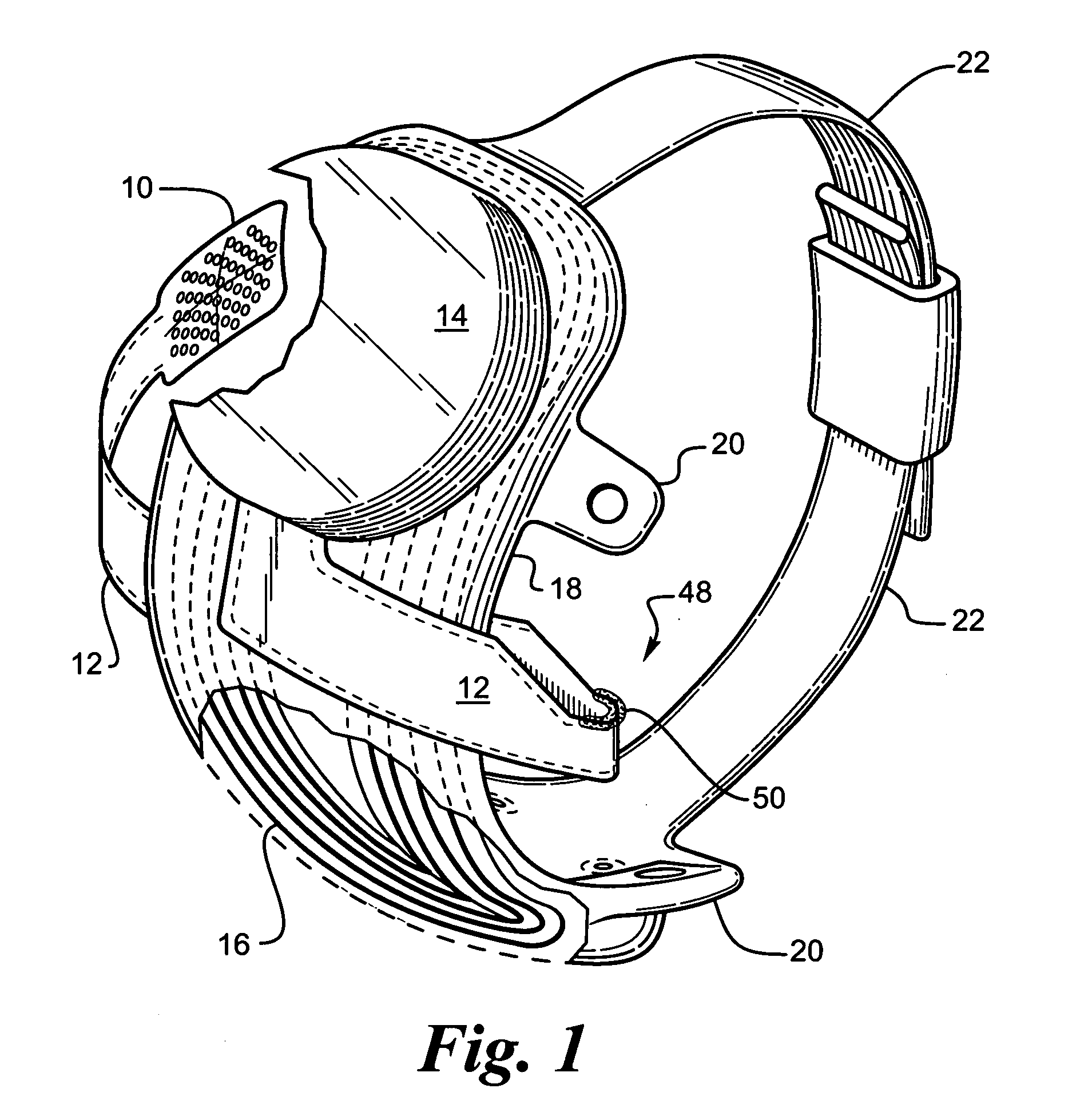 Visual prosthesis for improved circadian rhythms and method of improving the circadian rhythms