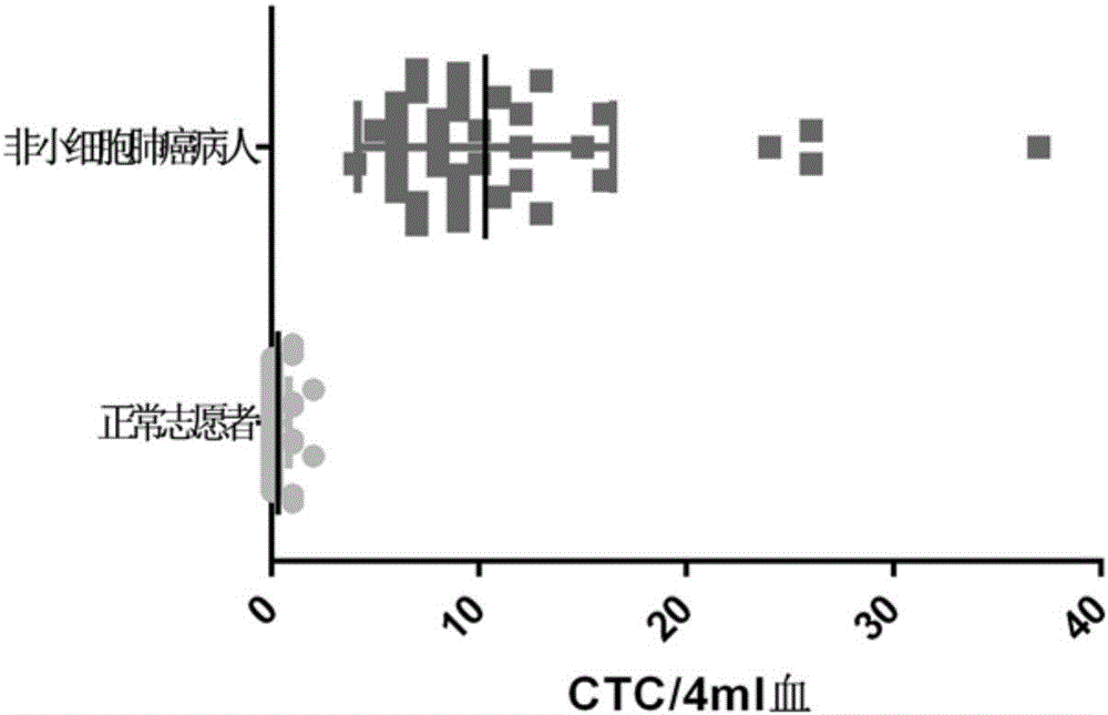 Recombinant herpes simplex virus HSV-hTERTp_ICP4_LungCA-GFP and diagnostic reagent kit