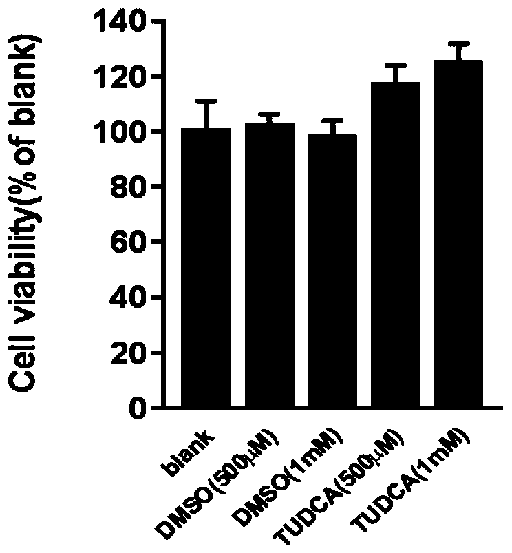 Application of tauroursodeoxycholic acid in drugs for resisting hand-foot-mouth virus and vesicular stomatitis virus