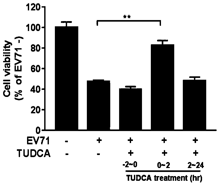 Application of tauroursodeoxycholic acid in drugs for resisting hand-foot-mouth virus and vesicular stomatitis virus