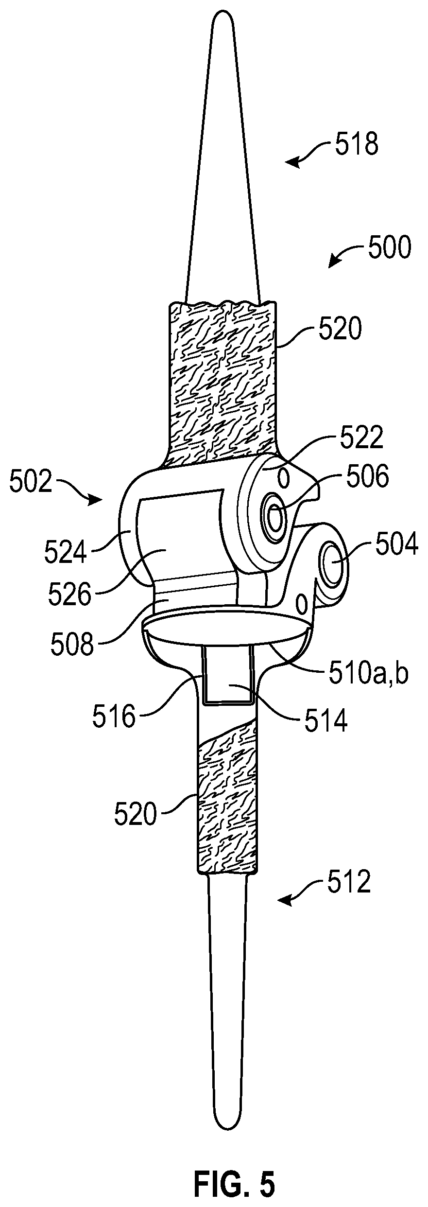 Implantable Knee Prosthesis with Integrated Prosthetic Extensor Mechanism.