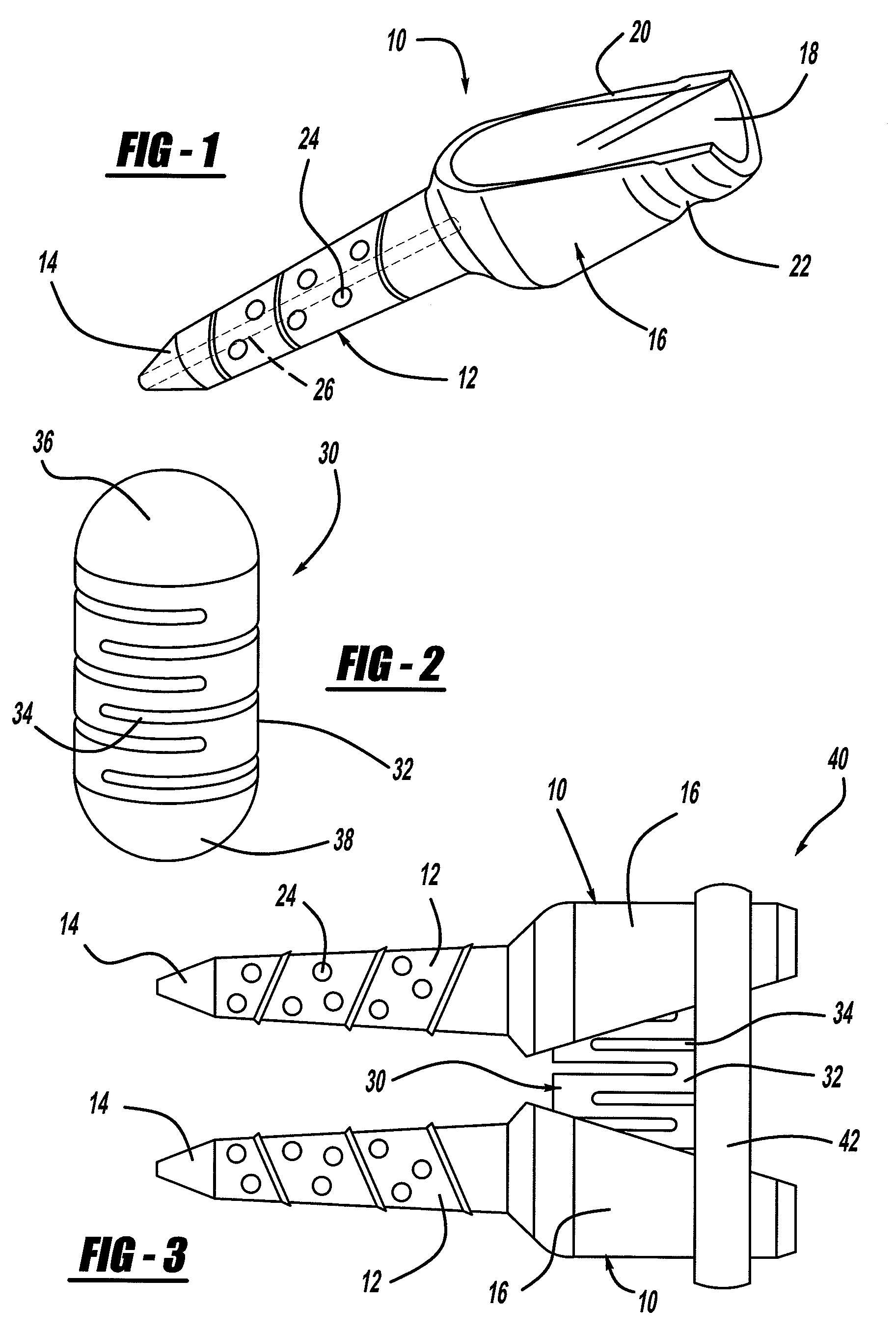 Surgical Screw Including a Body that Facilitates Bone In-Growth