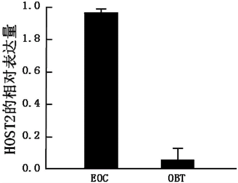 siRNA for inhibiting growth of epithelial ovarian cancer as well as recombinant vector and application thereof