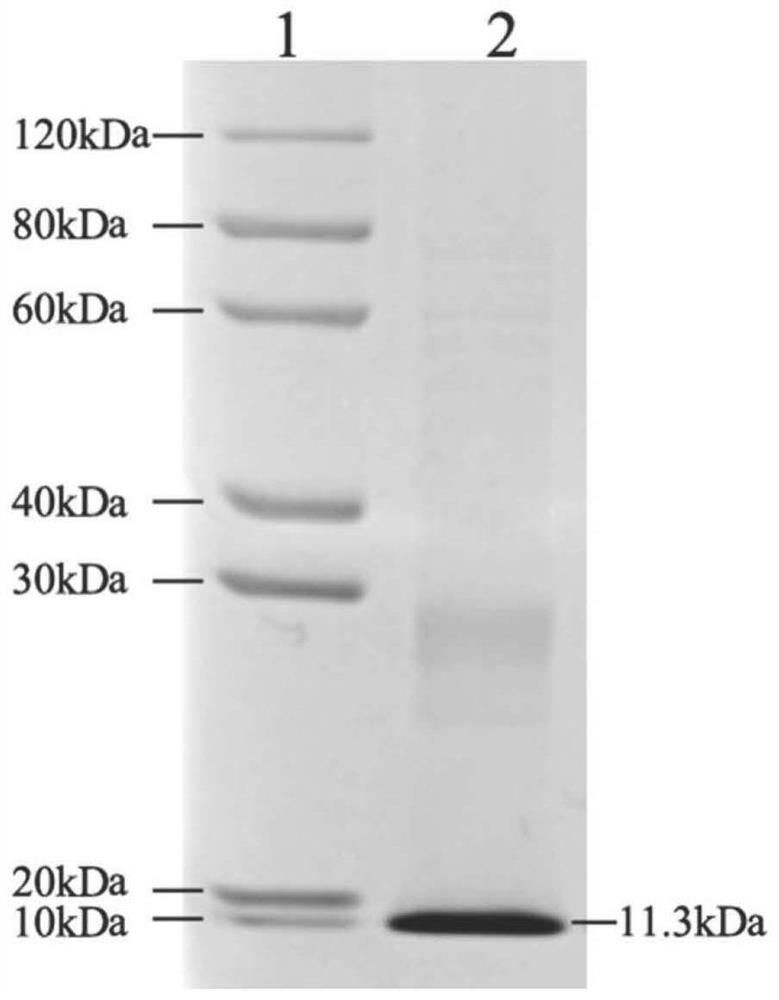 Application of schistosoma japonicum cysteine protease inhibitor to aspect of atherosclerosis