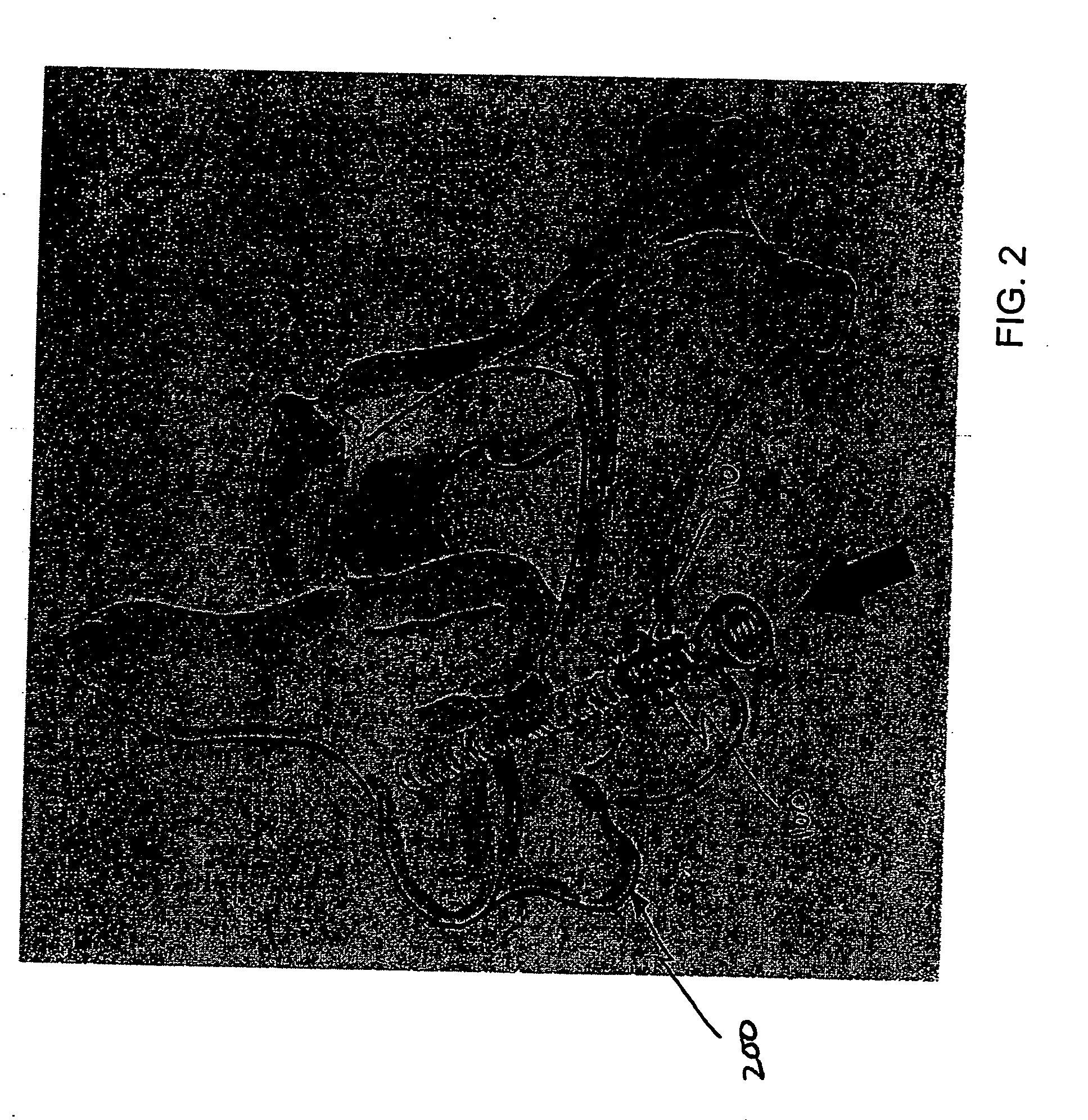 Method and device for delivering medicine to bone