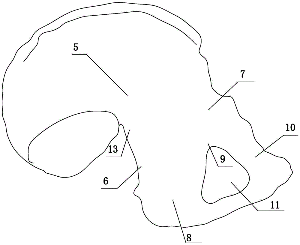 Fixing device and method for fractures of anterior and posterior columns of acetabulum