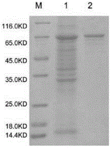 Alisma 3-hydroxy-3-methyl glutaric acyl coenzyme A reductase antibody preparation and detection method