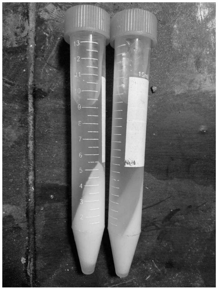 A method for quickly determining the solid content of phosphoric acid by using a centrifuge