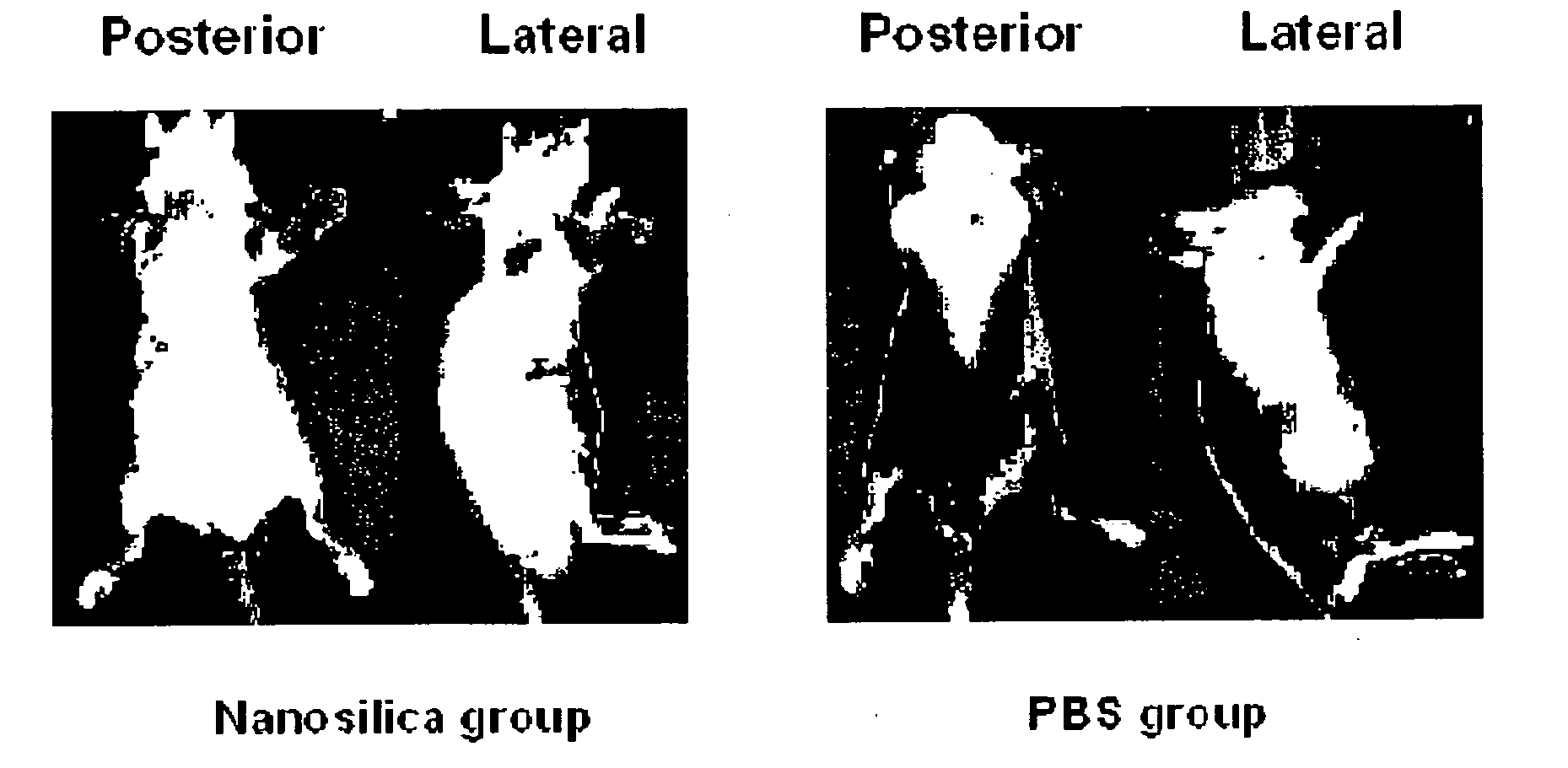 Fluorescent silica nanoparticle with radioactive tag and the detecting method of pet and fluorescent dual imaging using thereof