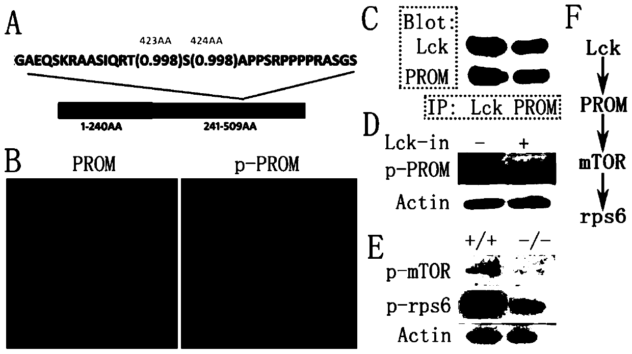 Polypeptide BPP capable of protecting and prolonging ovarian function and application of polypeptide BPP