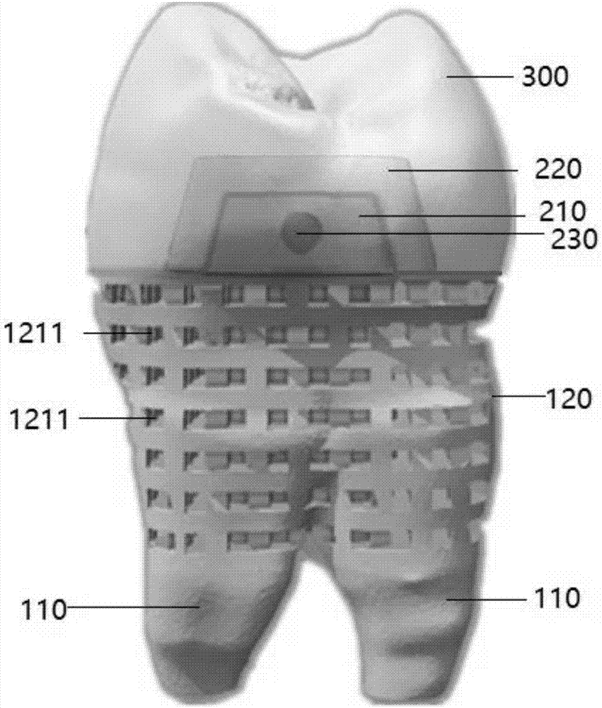 3D printing method of individualized porous-layer multi-tooth root implant