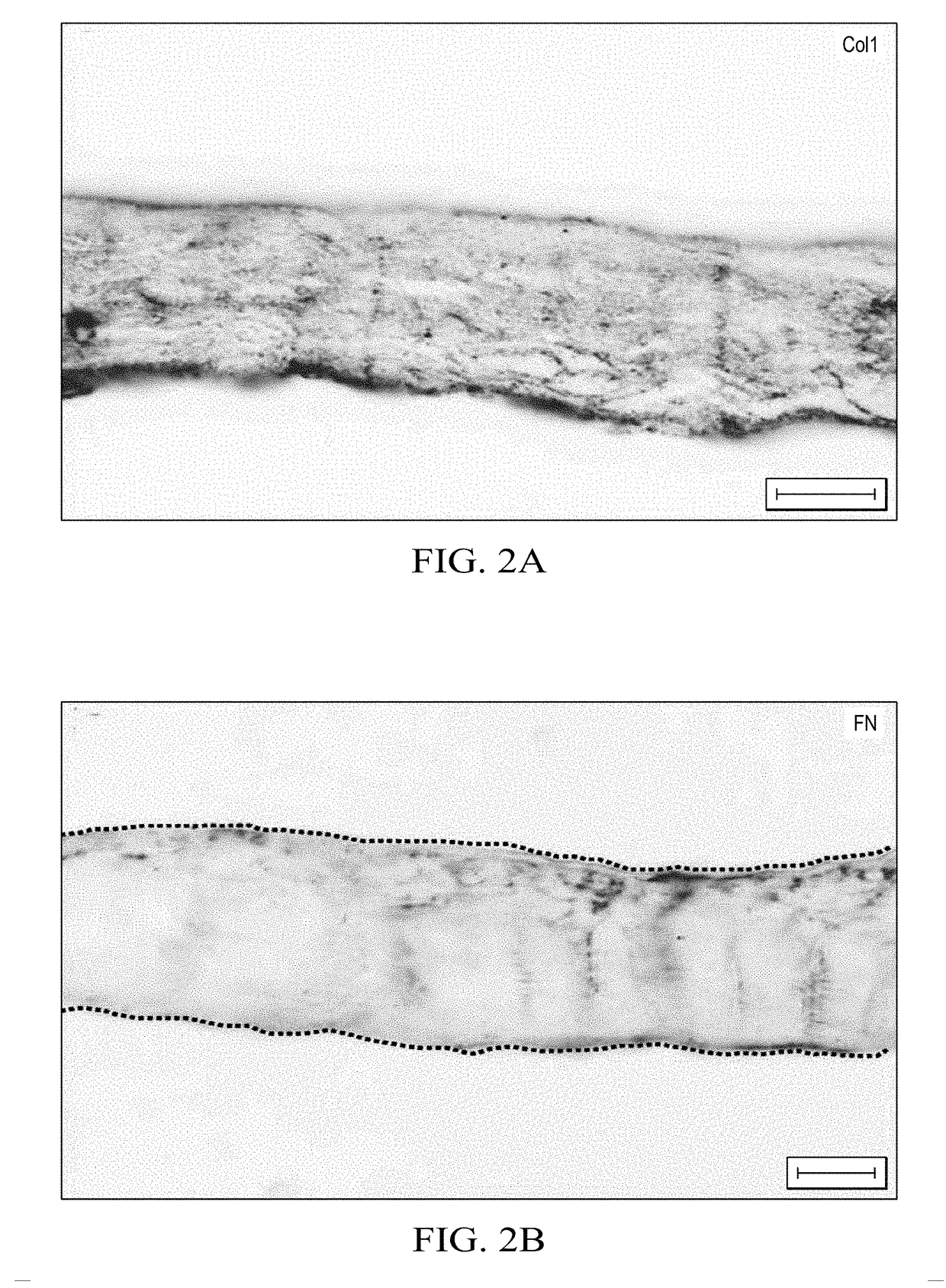 Decellularized biomaterial from mammalian tissue