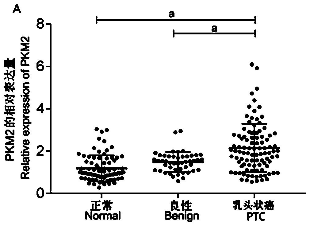 Biological sample marker relative to preoperative benign and malignant differential diagnosis of thyroid nodule and application thereof