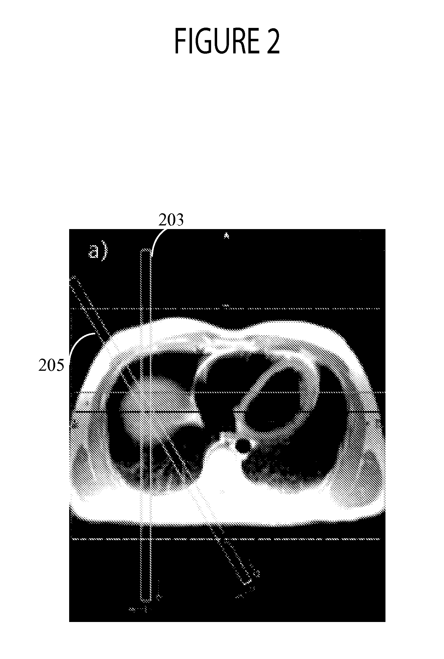 System for Multi Nucleus Cardiac MR Imaging and Spectroscopy