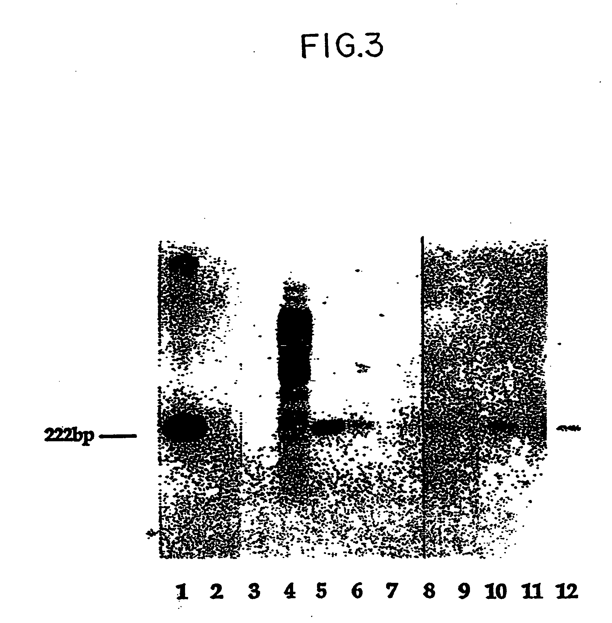 Non-invasive method for isolation and detection of fetal DNA