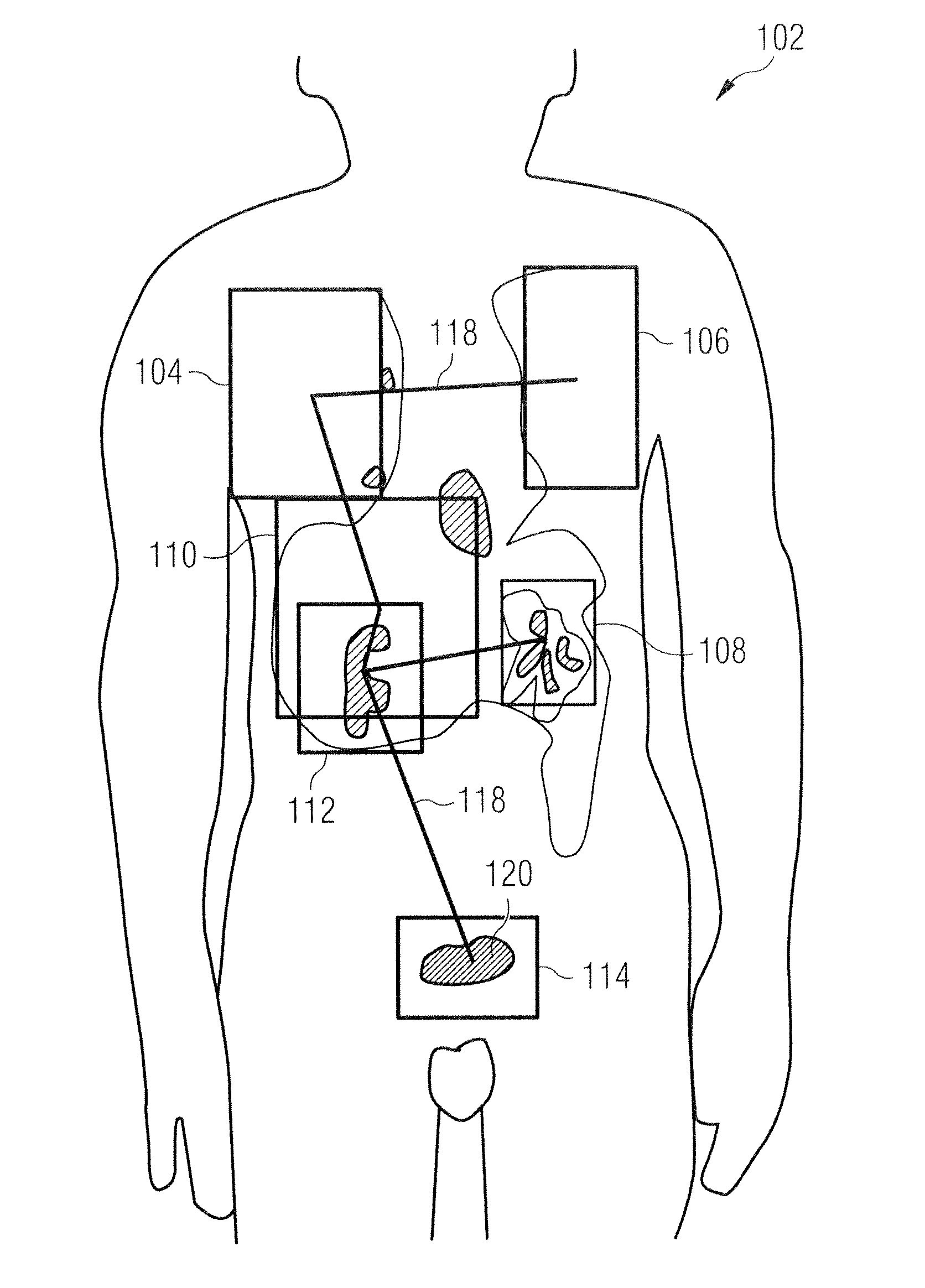 Methods and apparatus for registration of medical images