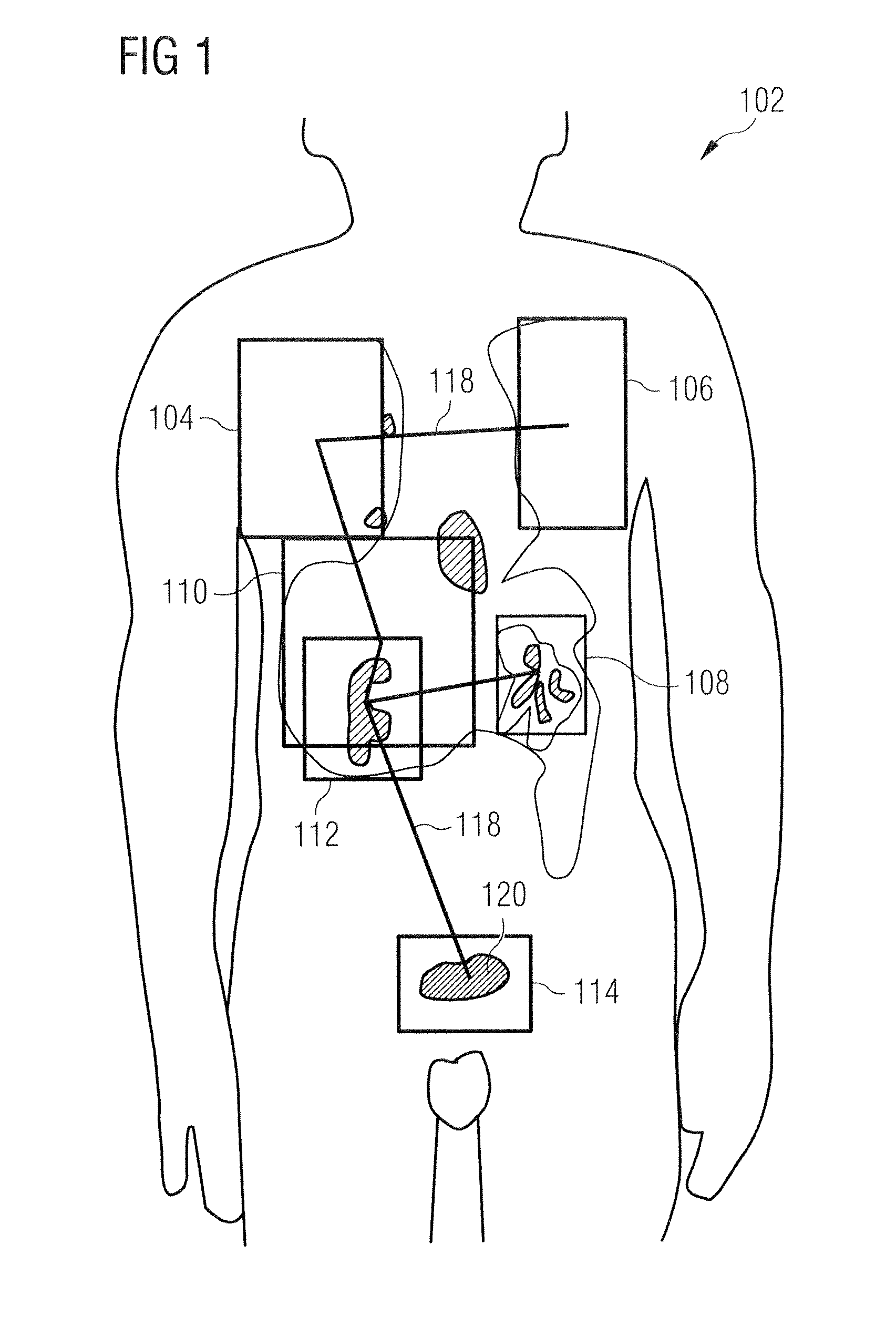 Methods and apparatus for registration of medical images