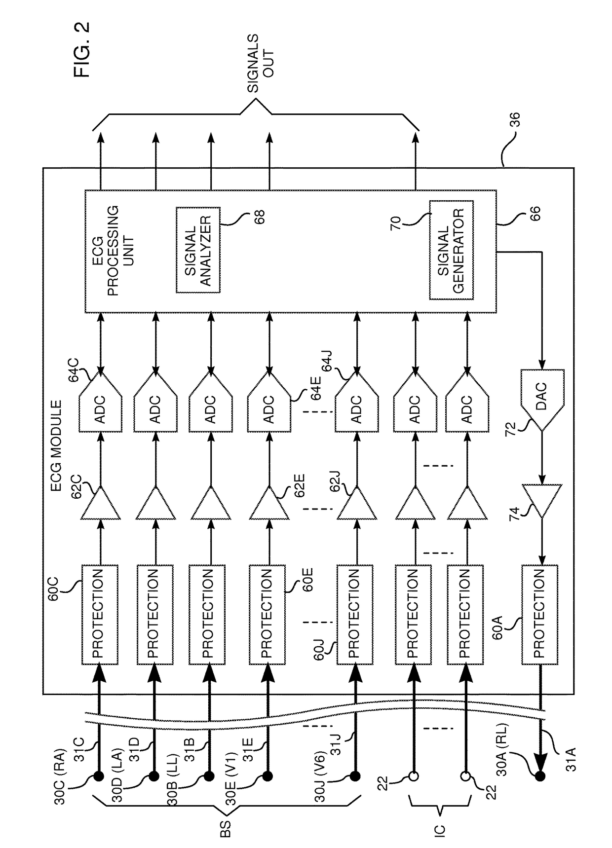 Multi-channel ECG measurement