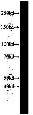 Enzyme-linked immunosorbent assay kit and preparation method thereof