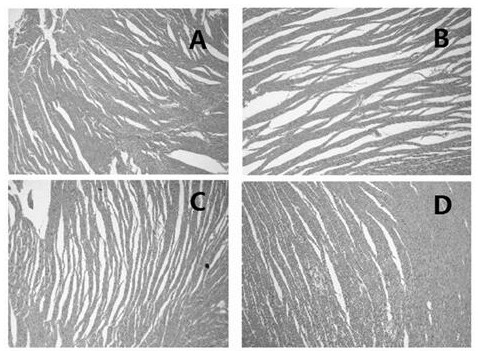 Houttuynia cordata volatile oil heart-protecting capsule for reducing toxicity and enhancing efficacy in chemotherapy and preparation method thereof