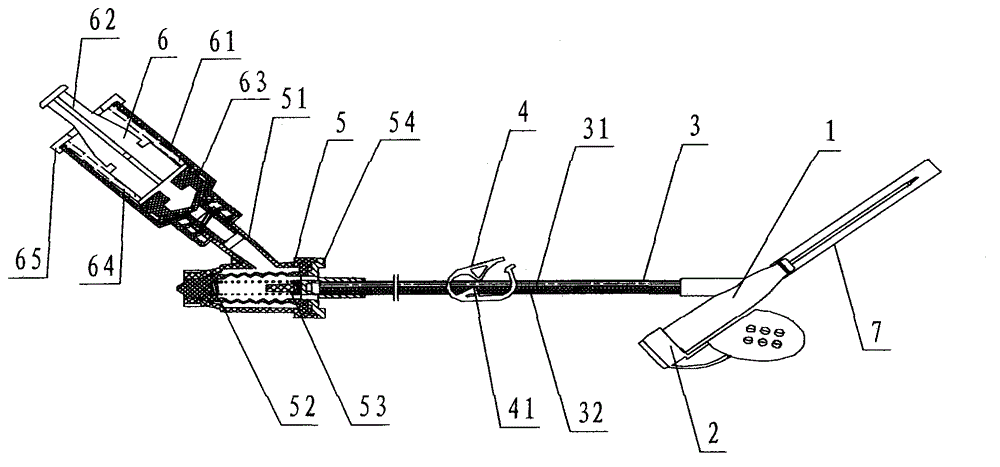 Remaining needle with slow release positive pressure