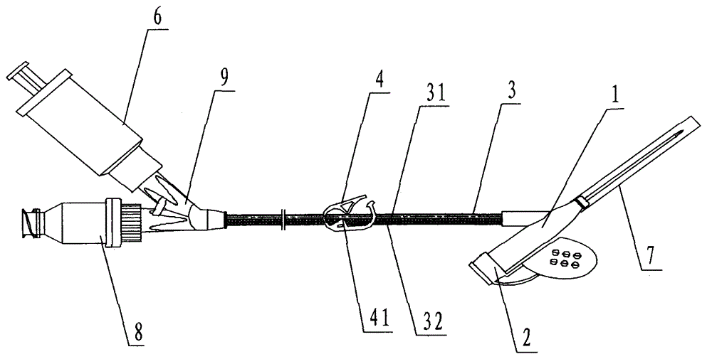 Remaining needle with slow release positive pressure