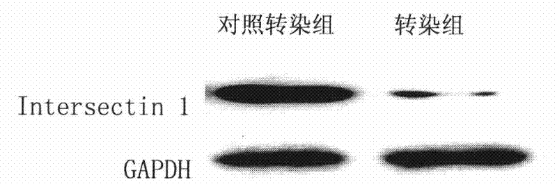 Bridge molecule 1-siRNA interference sequence and fusion expression vector thereof