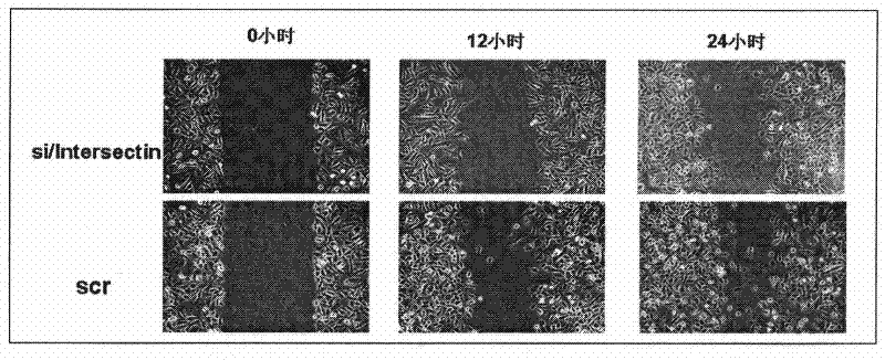 Bridge molecule 1-siRNA interference sequence and fusion expression vector thereof