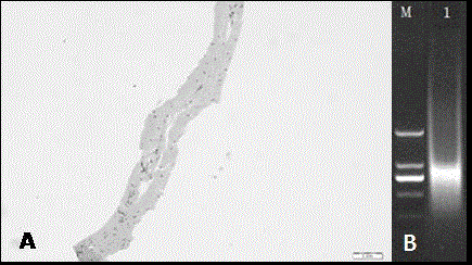 A kind of preparation method of tissue repair material