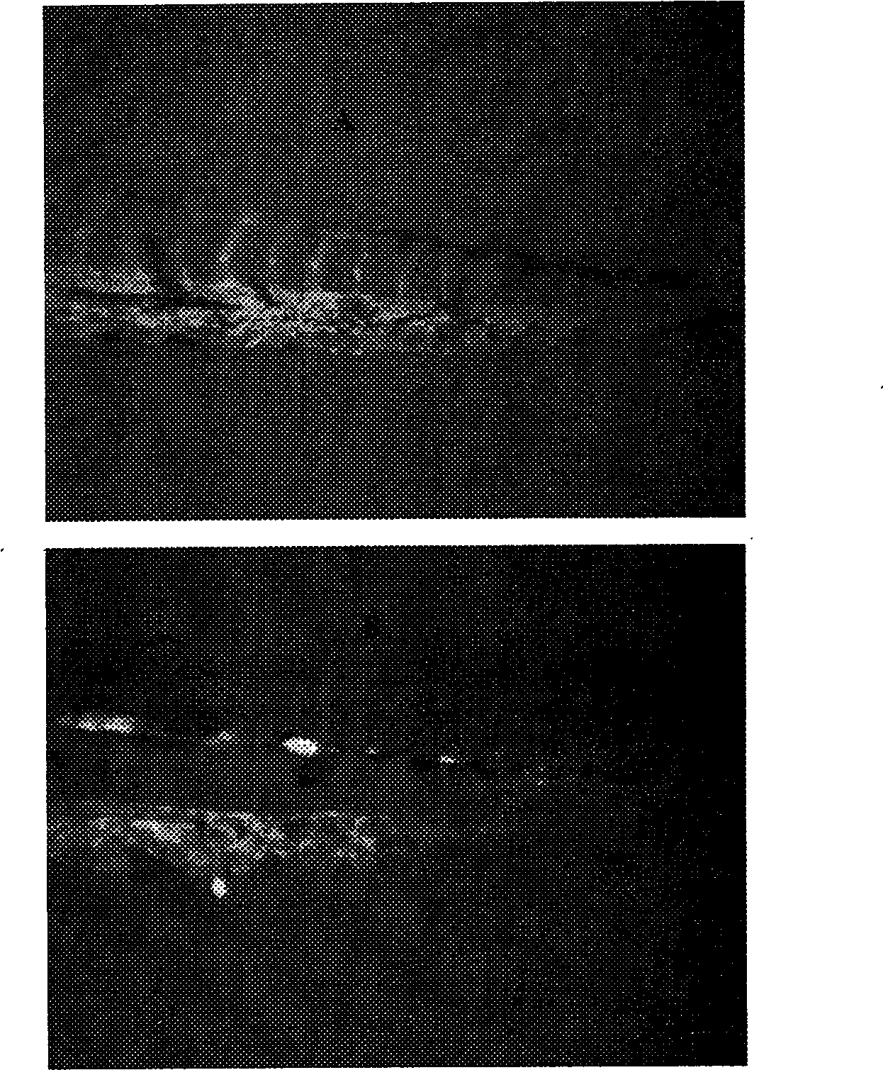 Antineoplastic medicine composition and application thereof