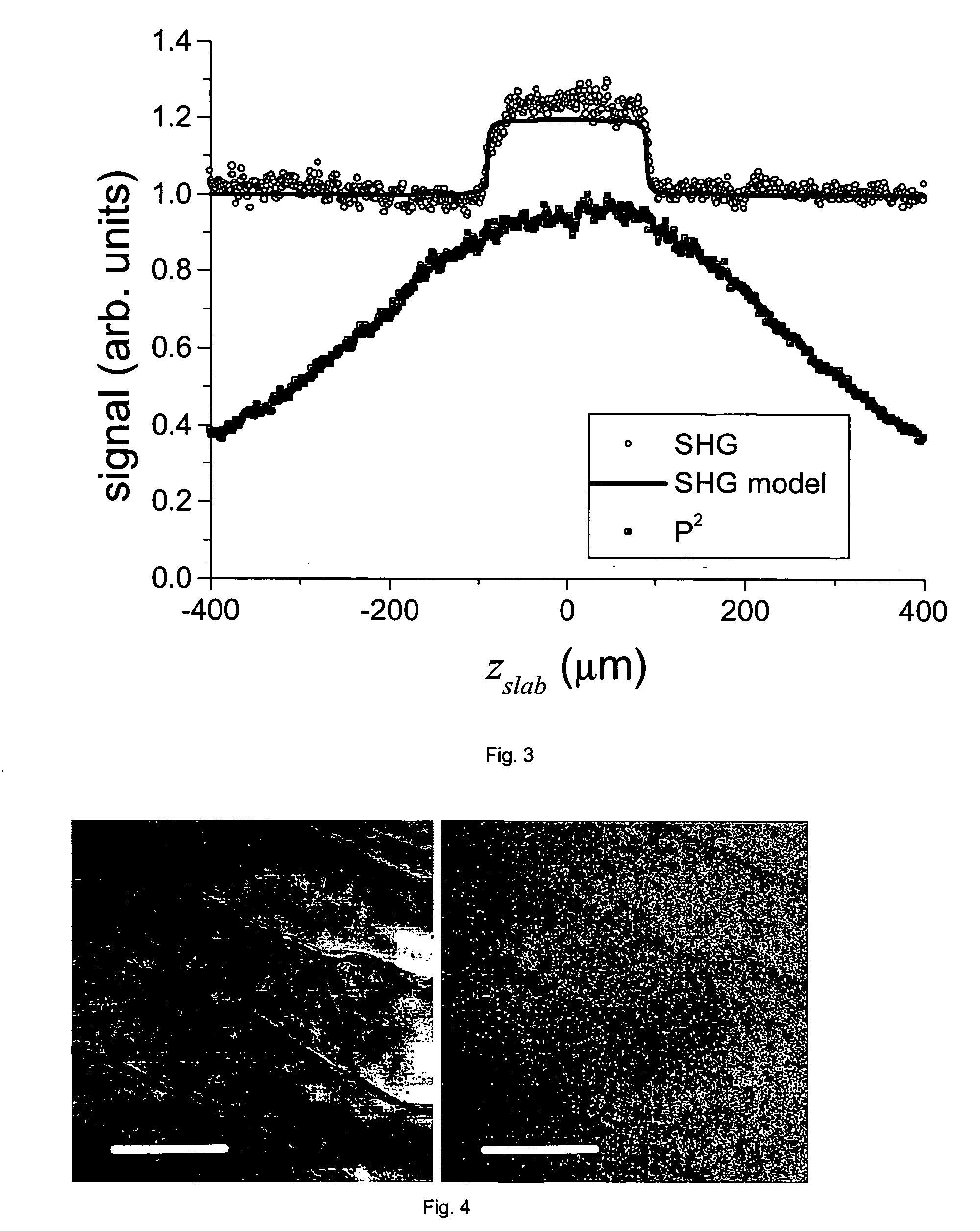 Confocal laser scanning microscopy apparatus