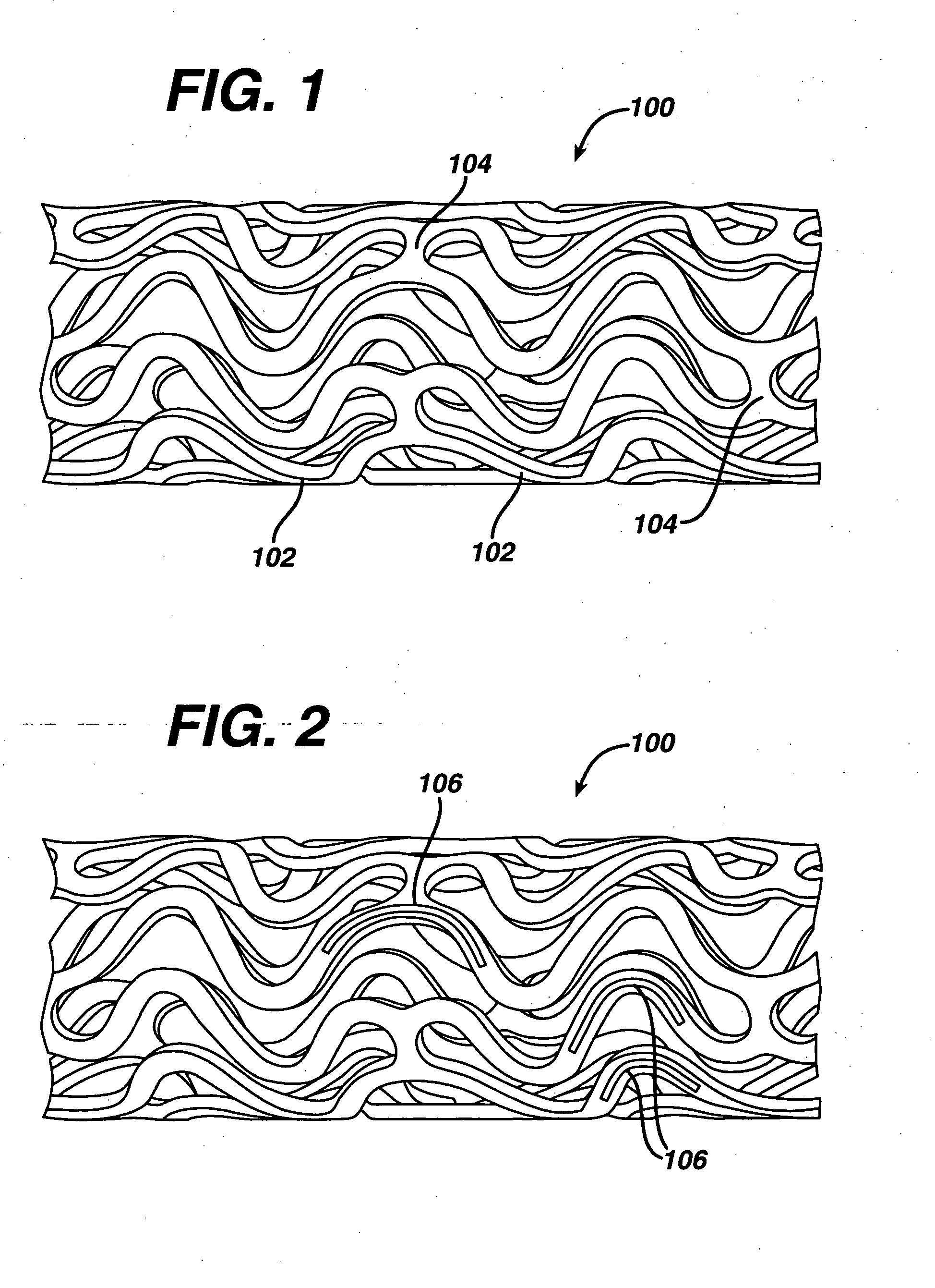 Local administration of a combination of rapamycin and cilostazol for the treatment of vascular disease