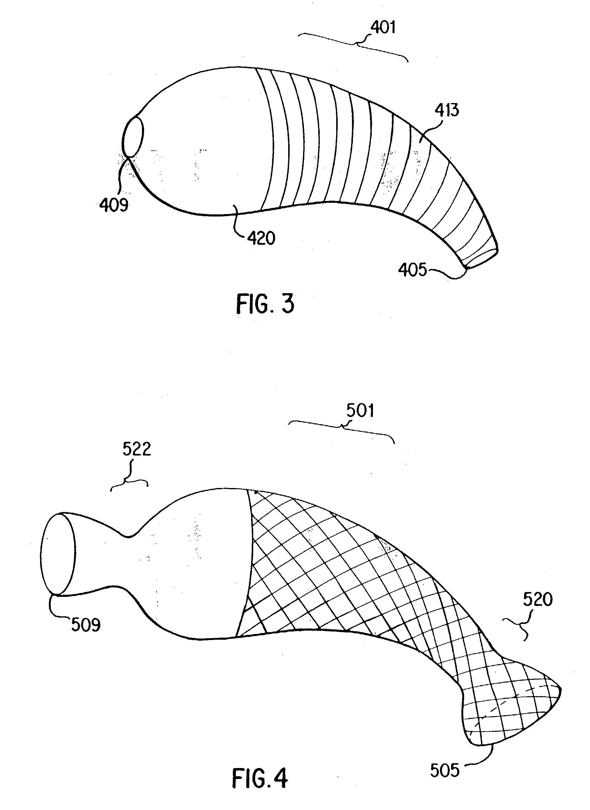 Stent for arterialization of the coronary sinus and retrograde perfusion of the myocardium