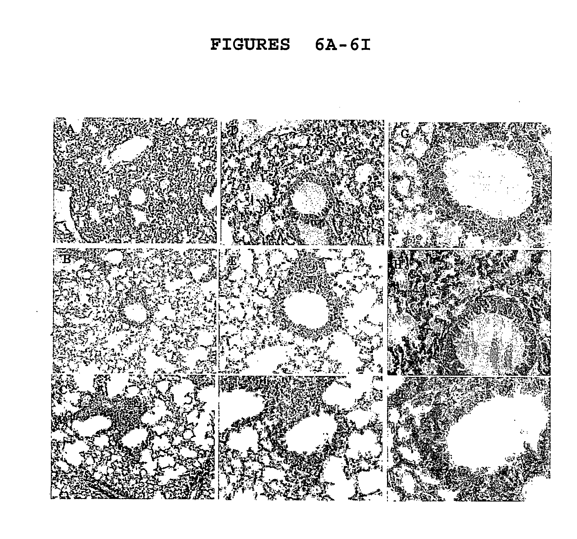 Method for preventing or reversing asthma and compositions useful therefor