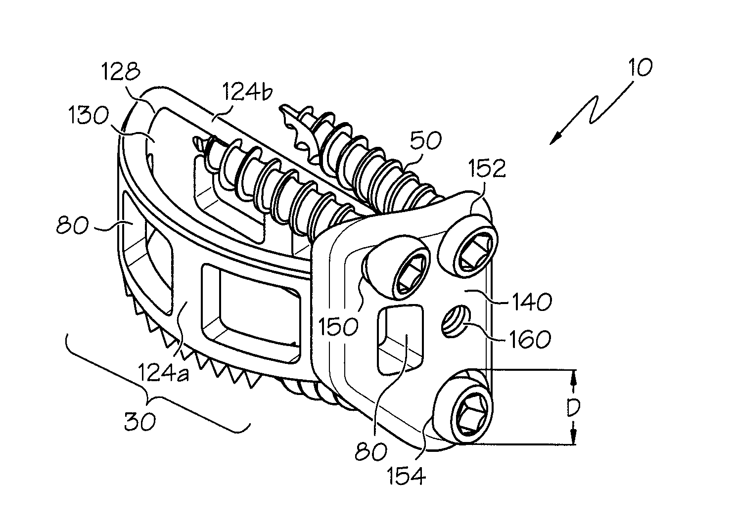 Lateral mount implant device