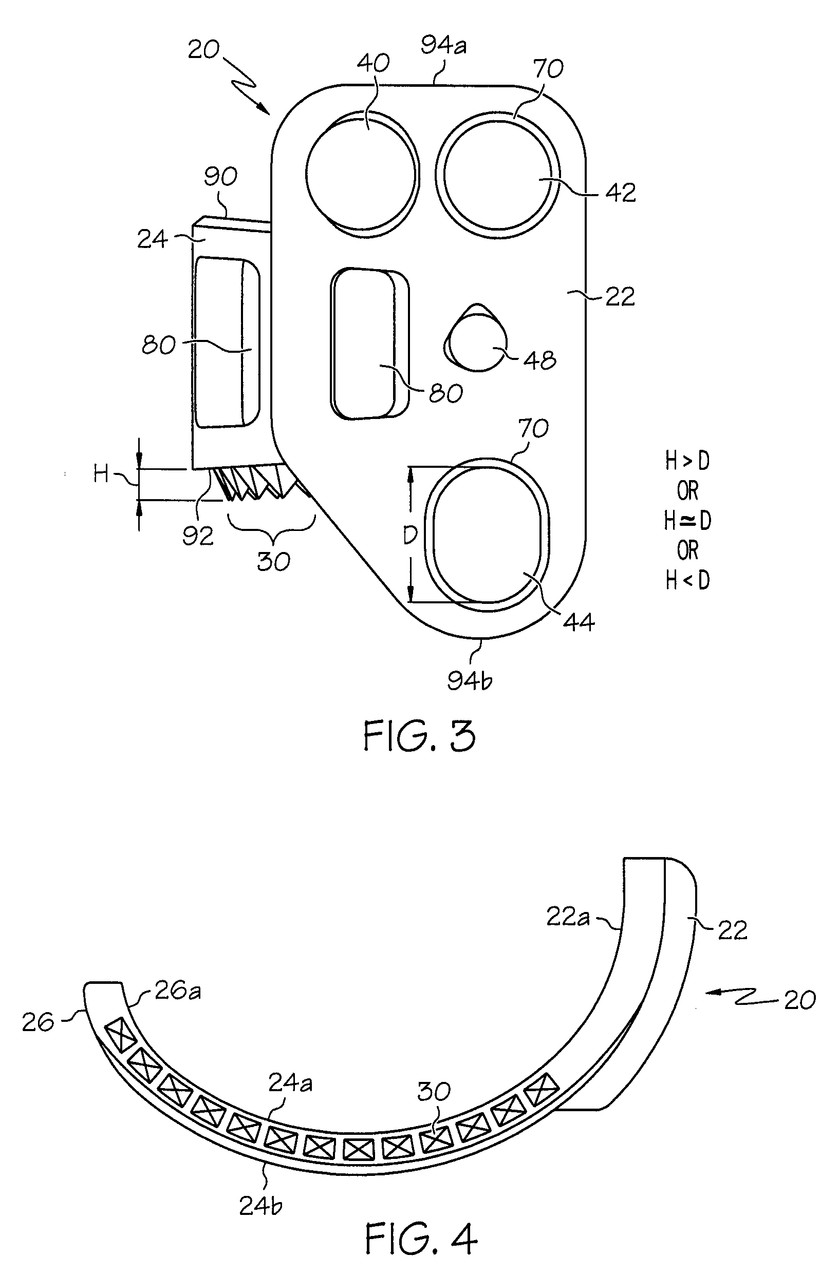 Lateral mount implant device