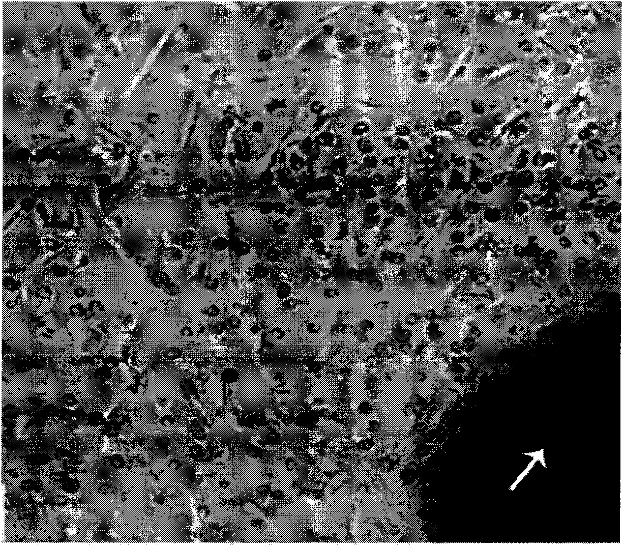 Method for enriching and extracting adult stem cells