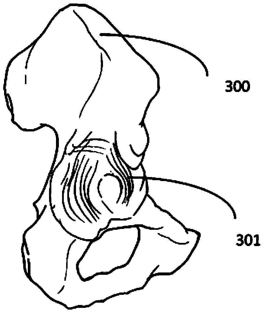 Customized hip joint surgical positioning device based on medical images and matched prosthesis