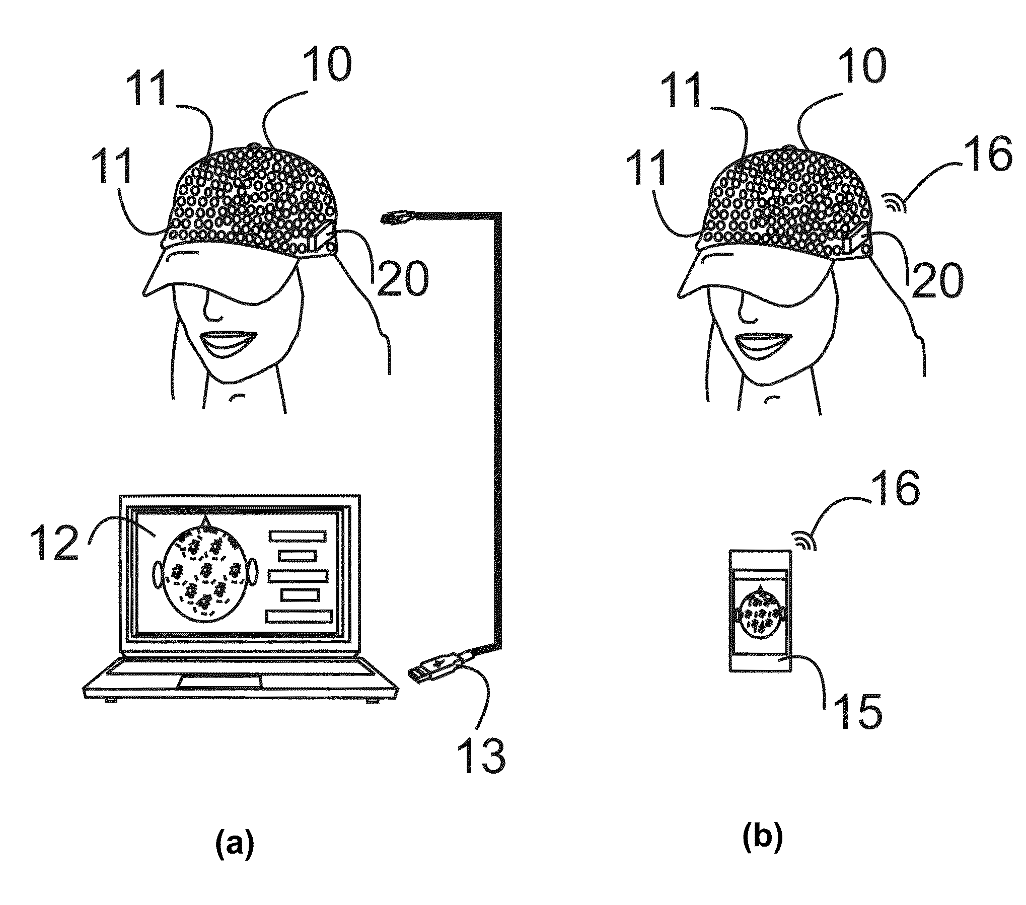 Vibratory neural stimulation