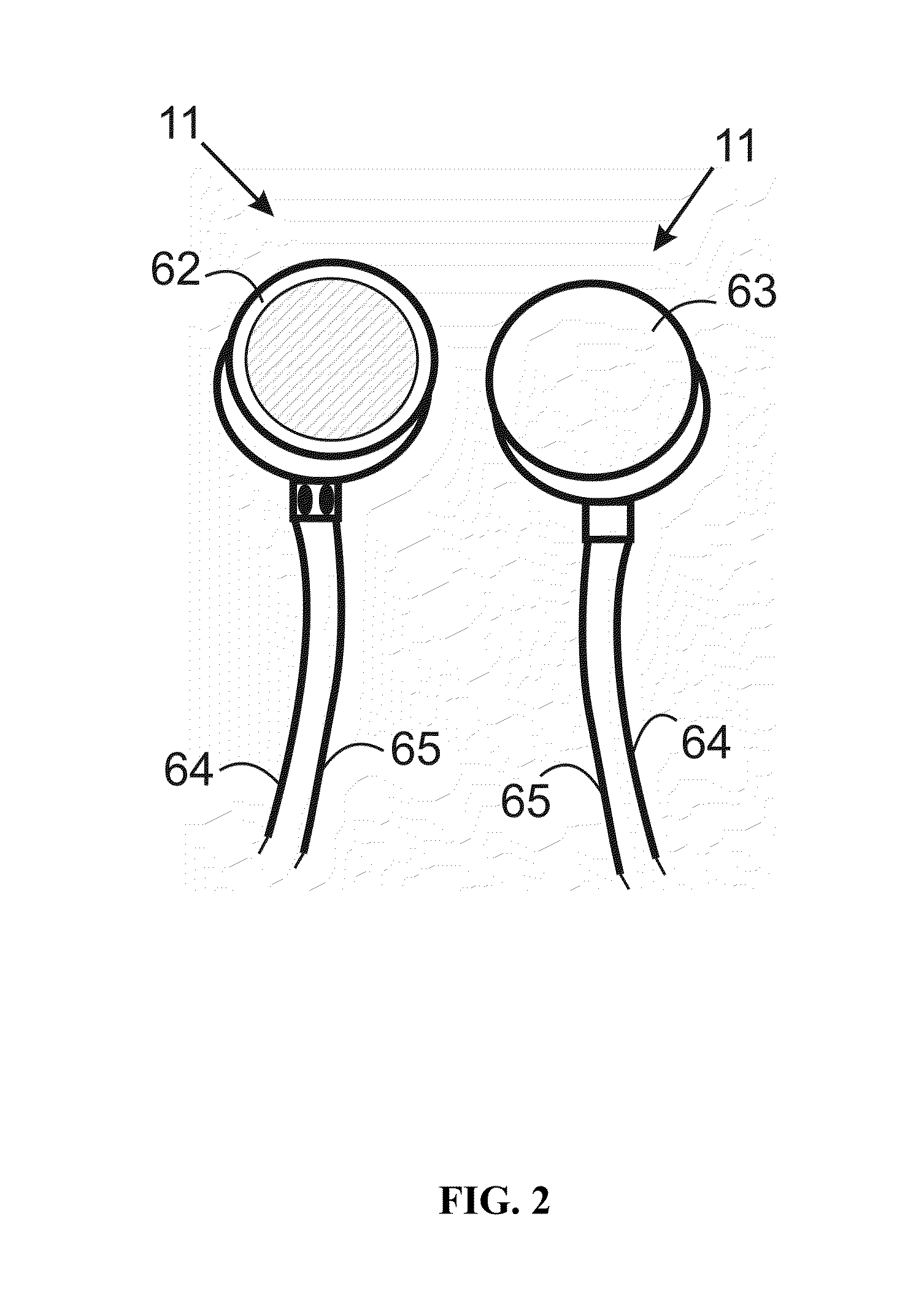 Vibratory neural stimulation