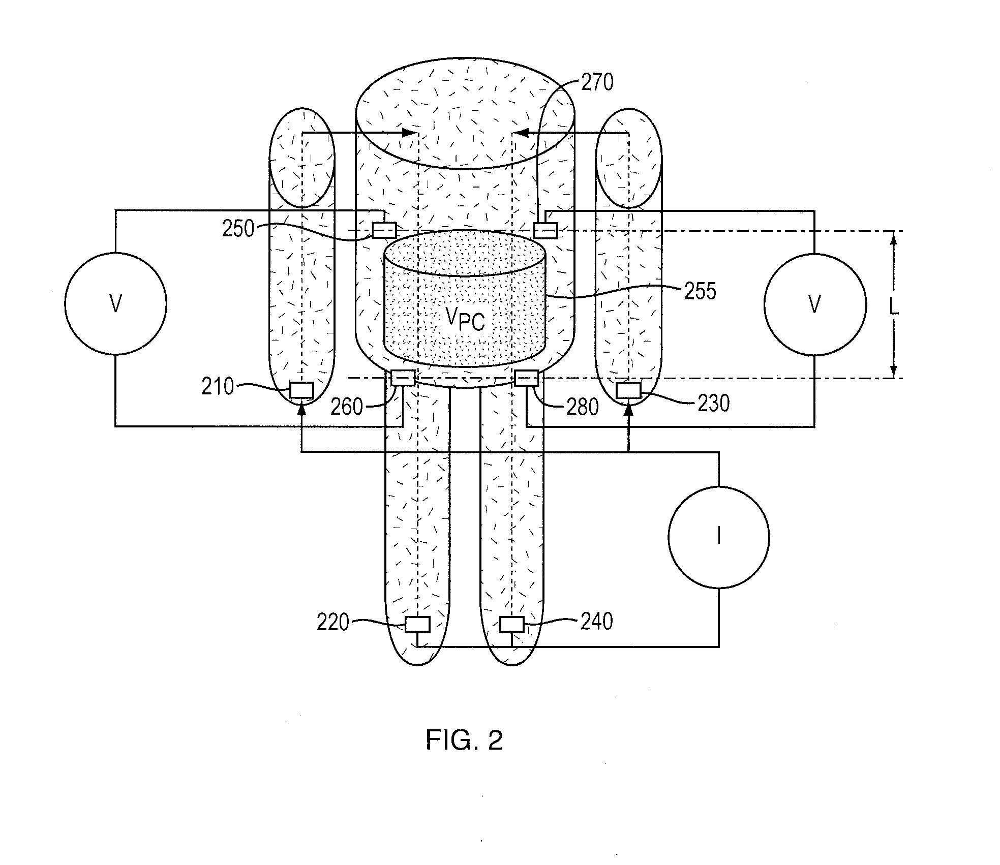 System and method of monitoring and control of ultrafiltration volume during peritoneal dialysis using segmental bioimpedance