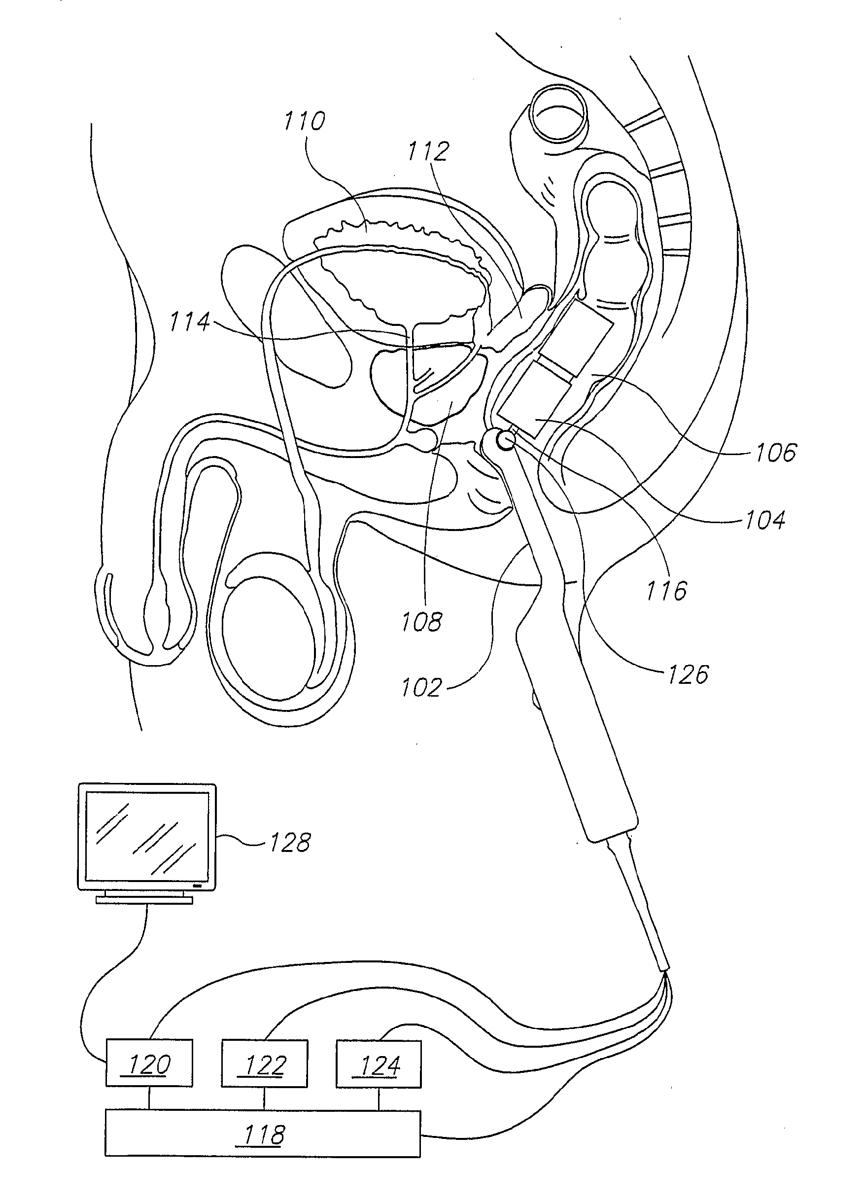 Mri Probe for Prostate Imaging